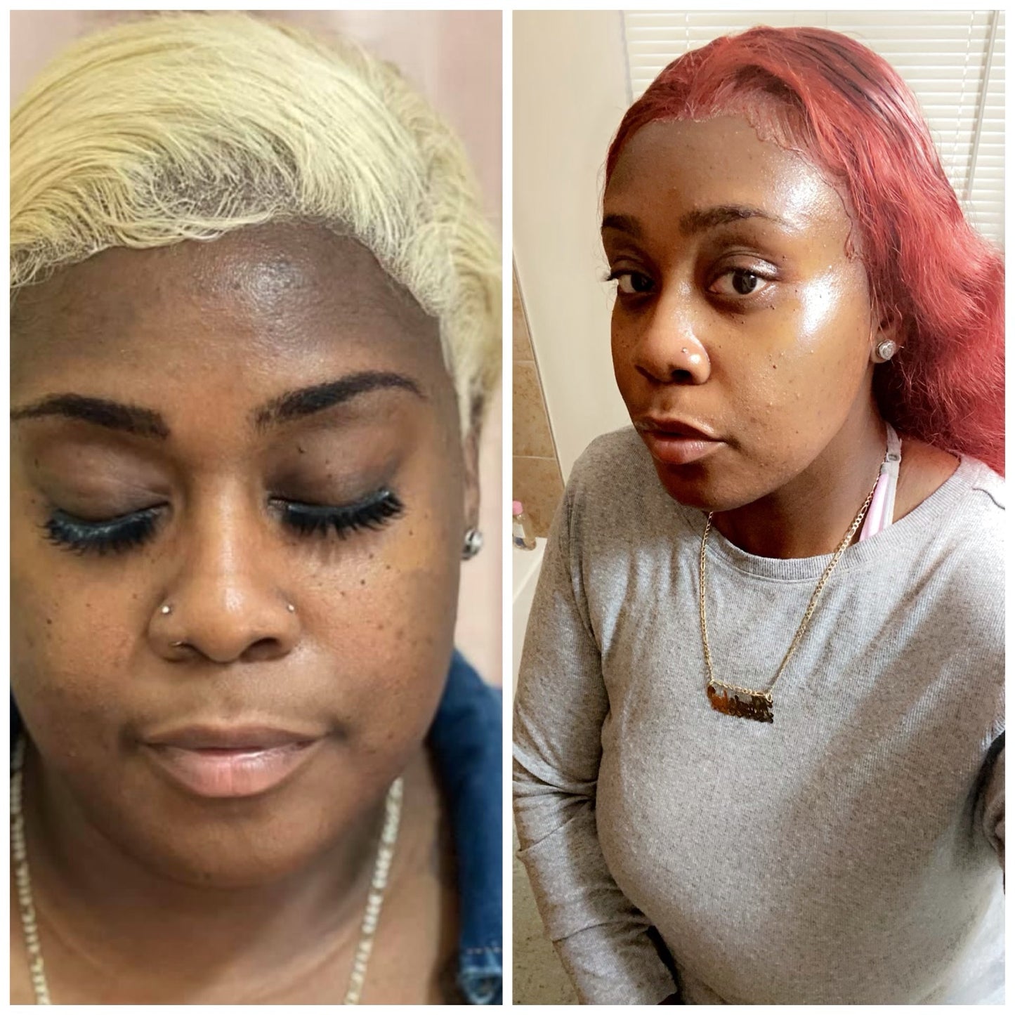 B-smooth tea tree eczema relief balm.